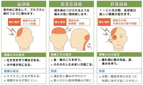 頭頂頭痛 原因|頭痛：どのように頭が痛い時病院行くべき？目安とタ。